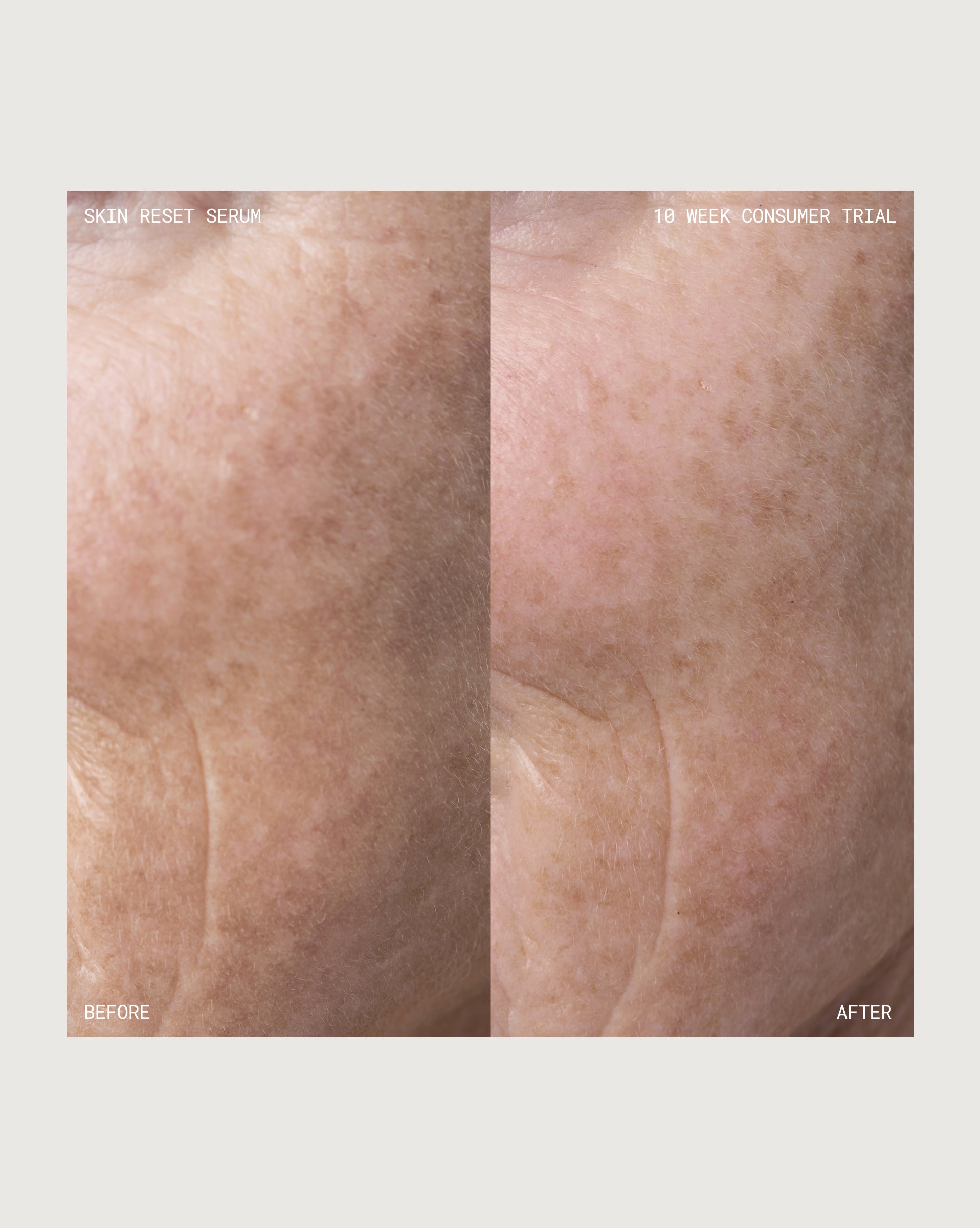 Skin Reset Serum Deluxe Mini